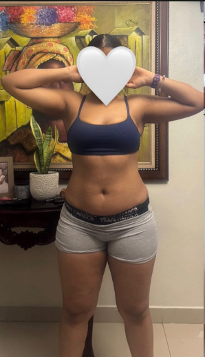 Foto de antes de la transformación física de Laura Medina